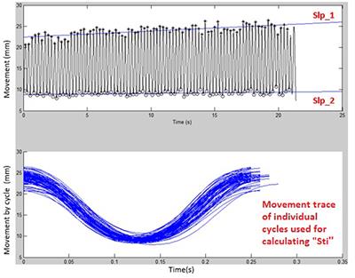 Assessing Oromotor Capacity in ALS: The Effect of a Fixed-Target Task on Lip Biomechanics